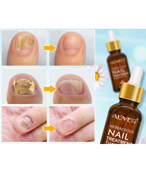 Solution Ongles 30 ml