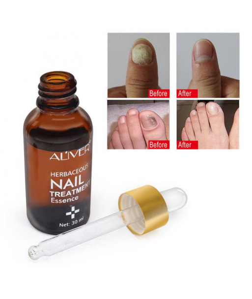Solution Ongles 30 ml